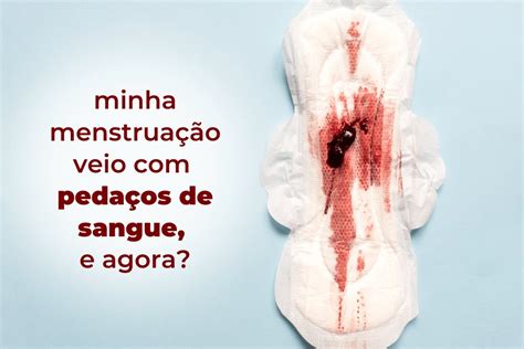 Sexo na menstruação: saiba o que pode e o que não。